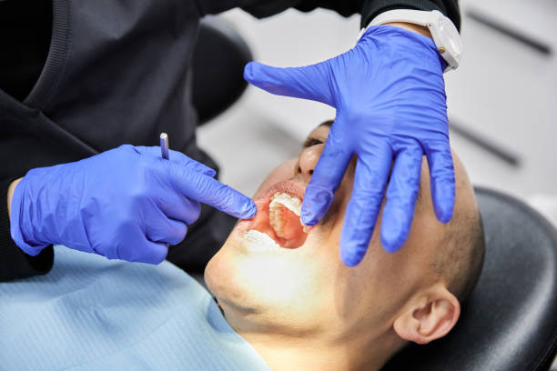 Best Emergency Dentist for Lost Fillings or Crowns in Yuma, CO